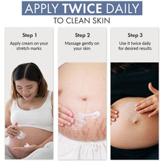 ThriveCo Stretch Marks Expert Serum Cream | Clinically Proven Treatment for New (red) & Old (white) Stretch Marks & Scars Removal | Infused with Collarev®, Striover™, Rosehip Oil & Squalane | For Women & Men | 30ml