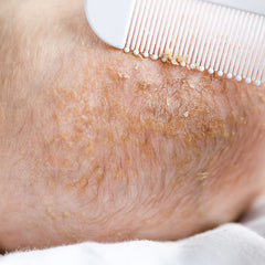 LuvLap Baby Comb with rounded Tips & Baby Hair Brush with Natural Bristles for better prrotection of baby's scalp (White & Blue) - Baby Product from LuvLap - Shop in Sri Lanka at Arcade.lk