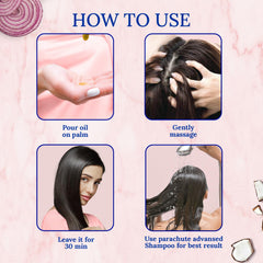 Parachute Advansed Onion Hair Oil for Hair Growth and Hair Fall Control with Natural Coconut Oil & Vitamin E - 200ml