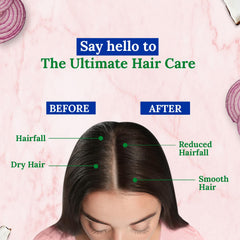 Parachute Advansed Onion Hair Oil for Hair Growth and Hair Fall Control with Natural Coconut Oil & Vitamin E - 200ml