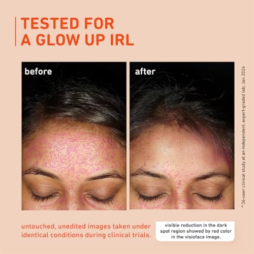 Plum 15% Vitamin C Serum for Glowing Skin | for Oily, Dry & Combination Skin | Reduce Pigmentation & Dark Spot |with Mandarin | Non-Irritating, Hydrating & Soothing | Unisex | 20ml