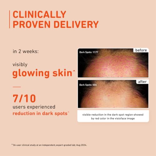Plum 15% Vitamin C Serum for Glowing Skin | for Oily, Dry & Combination Skin | Reduce Pigmentation & Dark Spot |with Mandarin | Non-Irritating, Hydrating & Soothing | Unisex | 20ml