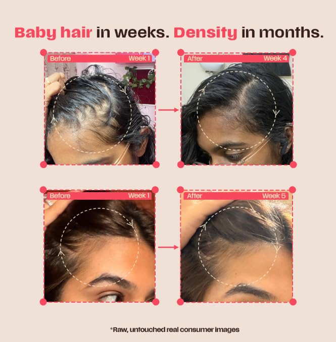 Days Ahead Leave-In Hair Growth Serum | Redensyl, Anagain, Caffeine & Ceramide | Promotes New Hair Growth | Advanced Anti Hair Fall Treatment | Non-Sticky, Oil-Control Formula |For Both Women & Men