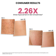 ThriveCo Smoothing Body Lotion for Dry, Rough & Bumpy skin | With AHA, Mahua Oil & Urea | Moisturizes, Hydrates & Treats Keratosis Pilaris,Strawberry Skin in Men & Women | 150 ml