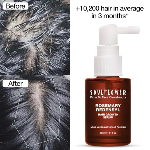 Soulflower Hair Growth Serum, Rosemary Oil, 3% Redensyl, 4% Anagain, Caffeine, Melanogray, Biotin, Rice Water, Clinically Tested, Hair growth & Hair fall control for Women & Men | 30ml
