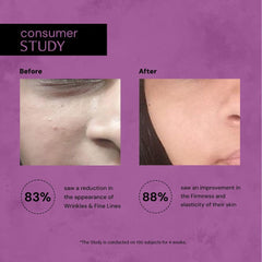 Deconstruct Retinol Face Serum with Peptide | 0.2% Retinol + 1% Peptide | Anti Aging Serum | Reduces Fine Lines & Wrinkles | Beginner Friendly Retinol Serum | For Men & Women - 30 ml each, pack of 2