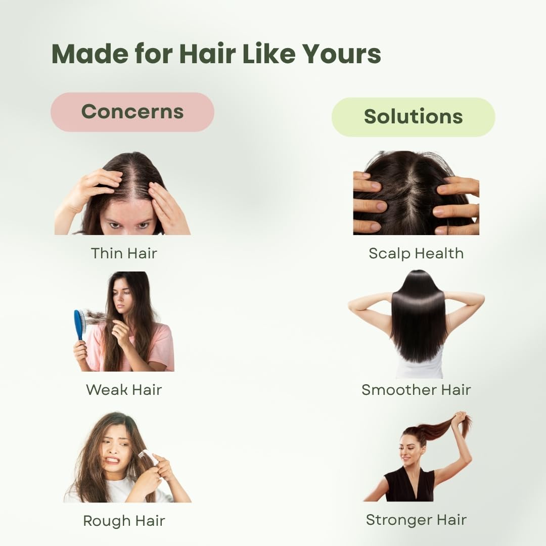 KAYROQ Rosemary Shampoo | 94% Stronger Hair | Enriched With Rosemary | Sulfate & Paraben Free | For Men & Women | 200 ML