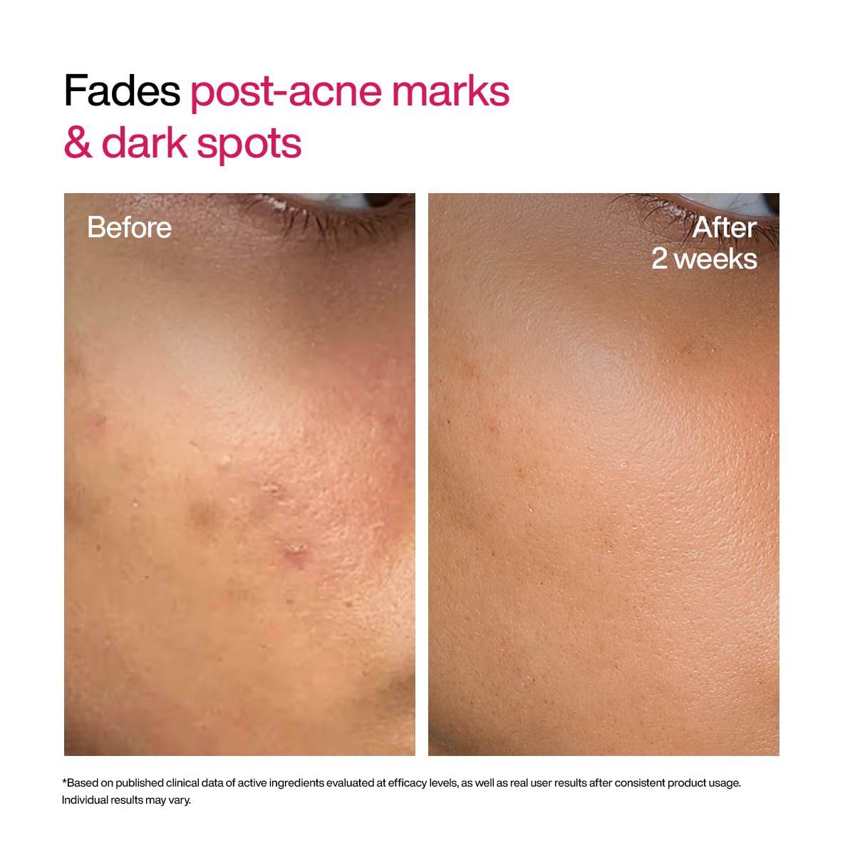 WishCare Advanced Dark Spot Correcting Serum - Niacinamide TXA Shot | 10% Niacinamide Face Serum For Pigmentation and Dark Spot | With 2% Alpha Arbutin & TXA for Glowing Skin | 10ml