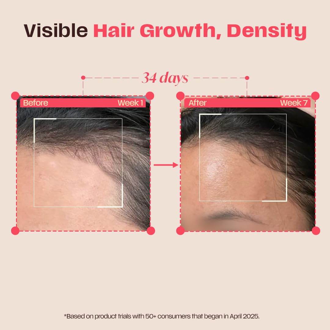 Days Ahead Leave-in Hair Growth Ampoule Serum (Roll on) | 16% Growth Actives | PDRN, Redensyl, Anagain | Hair Growth Serum | Promotes Growth, Increases Density | Non-Greasy | For Women & Men | 25 ml | Glammy.lk
