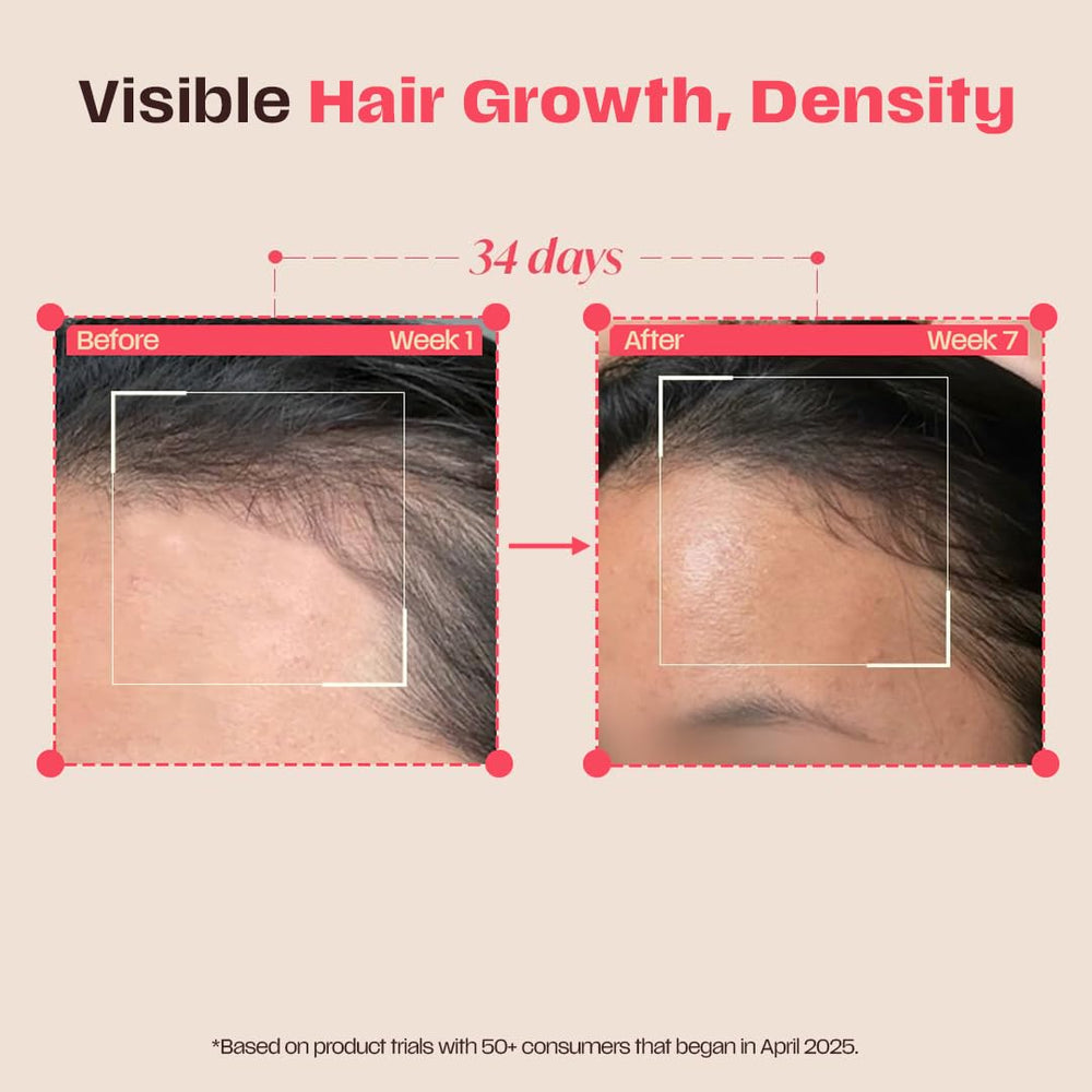 Days Ahead Leave-in Hair Growth Ampoule Serum (Roll on) | 16% Growth Actives | PDRN, Redensyl, Anagain | Hair Growth Serum | Promotes Growth, Increases Density | Non-Greasy | For Women & Men | 25 ml | Glammy.lk
