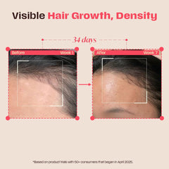 Days Ahead Leave-in Hair Growth Ampoule Serum (Roll on) | 16% Growth Actives | PDRN, Redensyl, Anagain | Hair Growth Serum | Promotes Growth, Increases Density | Non-Greasy | For Women & Men | 25 ml | Glammy.lk