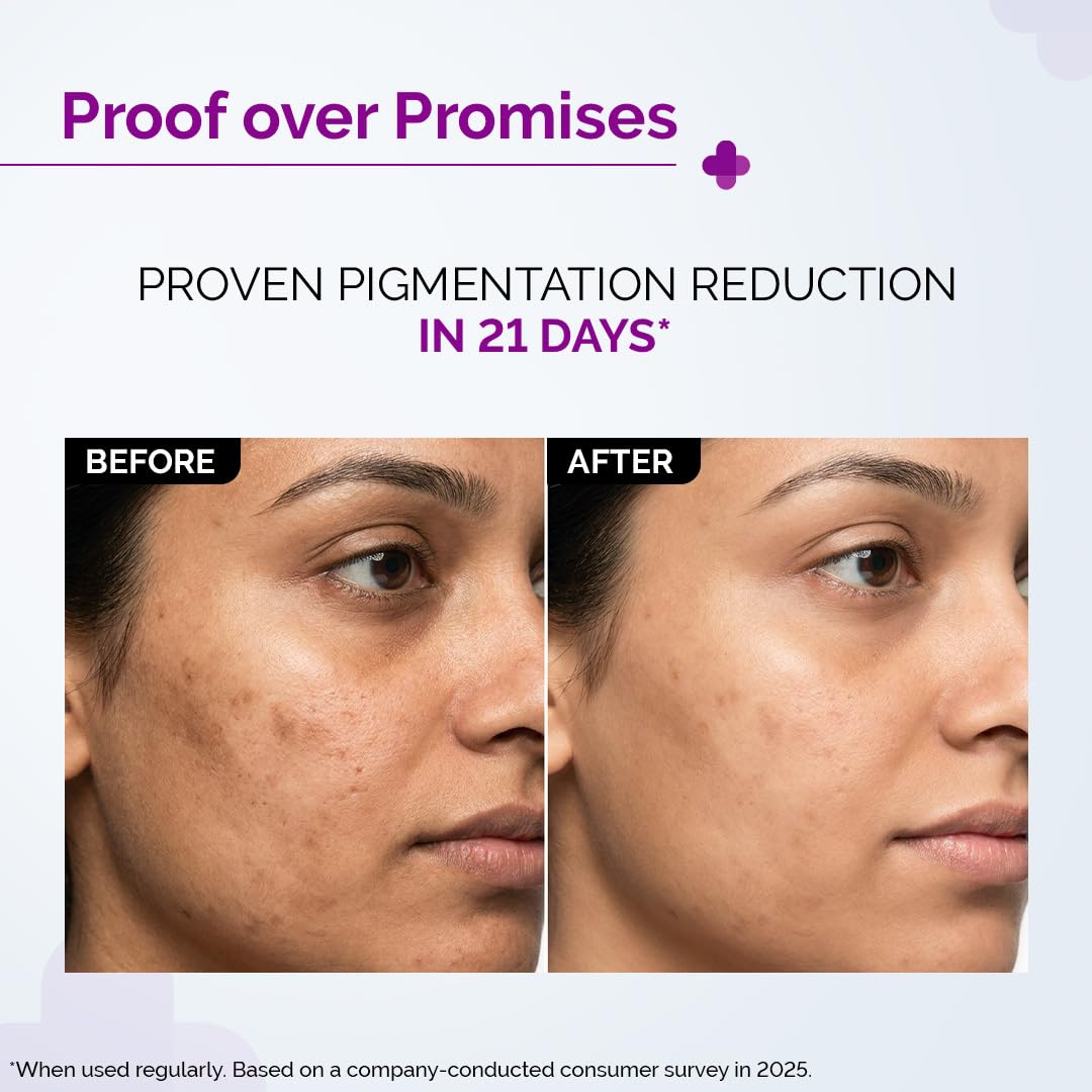 The Derma Co. 2% Kojic Acid Face Serum with Alpha Arbutin, Powered by Deep Penetration Formula™ | Fights Pigmentation | Fades Dark Spots | Brightens & Evens Skin Tone | 30 ml