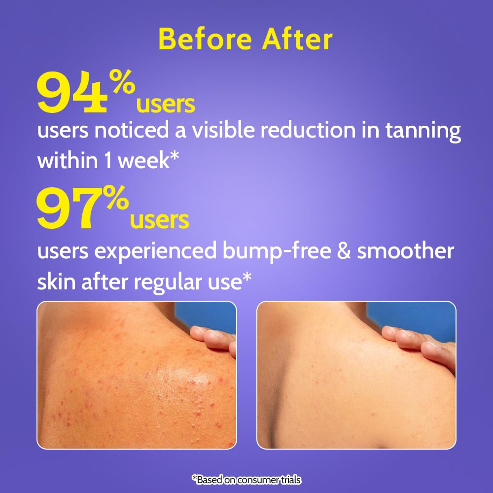 Chemist At Play Exfoliating Body Wash 236ml | Removes Tan, Fights Body Acne, Strawberry Skin | 4% (Salicylic Acid, Vitamin E & Lactic Acid) | Gentle Exfoliating Detan Shower Gel For Women & Men