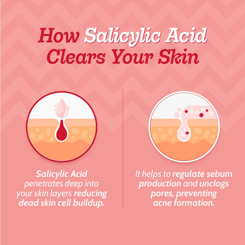 Chemist At Play 2% Salicylic Acid Face Serum for Acne-Prone Skin | Treats Active Acne & Controls Oil | Fades Acne Marks | Improves Skin Texture | Lightweight, Non-Comedogenic | For Men & Women | 30 ml