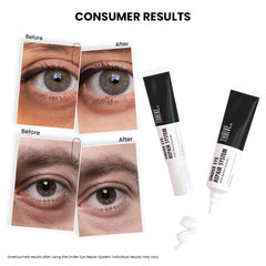 ThriveCo Anti-Ageing Under Eye Repair Cream for Dark Circles, Fine Lines, Wrinkles & Puffiness | With Retinol, Niacinamide & CollaRev for Men & Women | 15 ml