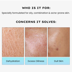 Hyphen 2% Cica Exosomes Oil-Free Moisturizer | Winter Skincare | 10X Deeper Hydration | Lightweight Water Gel with 5% Niacinamide | Controls Oil, Non-Comedogenic | Acne-Prone, Dry & Oily Skin - 50ml