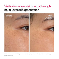 WishCare Advanced Dark Spot Correcting Serum - Niacinamide TXA Shot | 10% Niacinamide Face Serum For Pigmentation and Dark Spot | With 2% Alpha Arbutin & TXA for Glowing Skin | 10ml