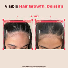 Days Ahead Leave-in Hair Growth Ampoule Serum (Roll on) | 16% Growth Actives | PDRN, Redensyl, Anagain | Hair Growth Serum | Promotes Growth, Increases Density | Non-Greasy | For Women & Men | 25 ml | Glammy.lk
