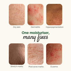 Elovera Moisturising Cream 75g | For Dry Skin | with Aloe Vera & Vitamin E | Protects, Nourishes and Repairs Skin | Paraben Free | Fragrance Free