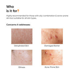 Minimalist Vitamin B5 10% Oil-Free Moisturizer for Face, Lightweight Gel Moisturizer for Oily & Combination Skin, Barrier Repair Face Cream with Glycerine 50gm