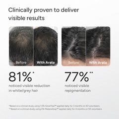 Arata Anti Grey Hair & Beard Serum with 2% MelanoGray, 1.5% Silverfree™, 1% Arcolys | Boosts Melanin Production | Promotes Natural Pigmentation | Reduces Grey Hair | 30ml