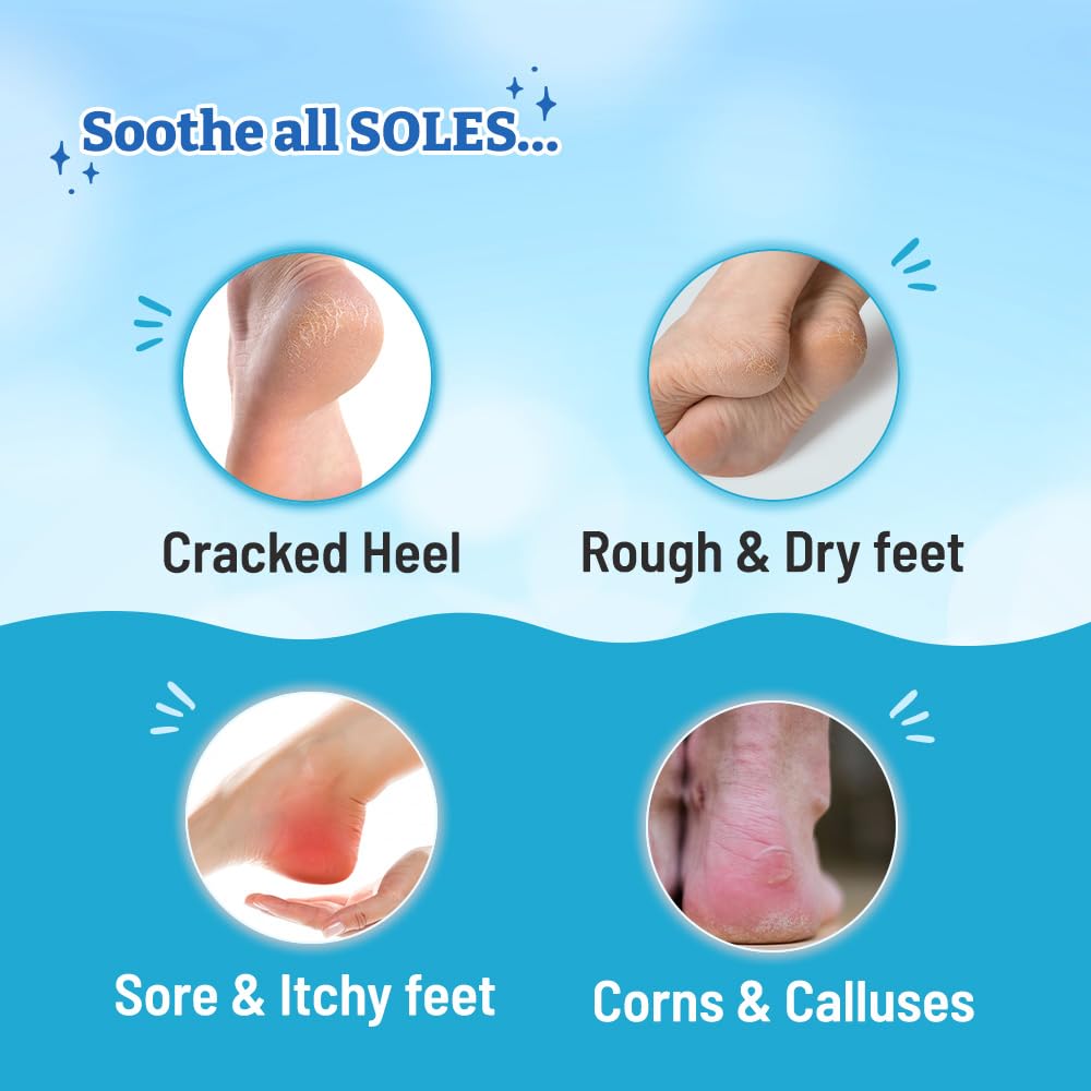 Chemist at Play Foot Cream for Cracked Heels & Diabetic Foot | Up to 24 hours of Moisturization | 10% Urea & Natural AHAs | Nourishment & Hydration | For Dry & Cracked Feet | Lightweight | 50g