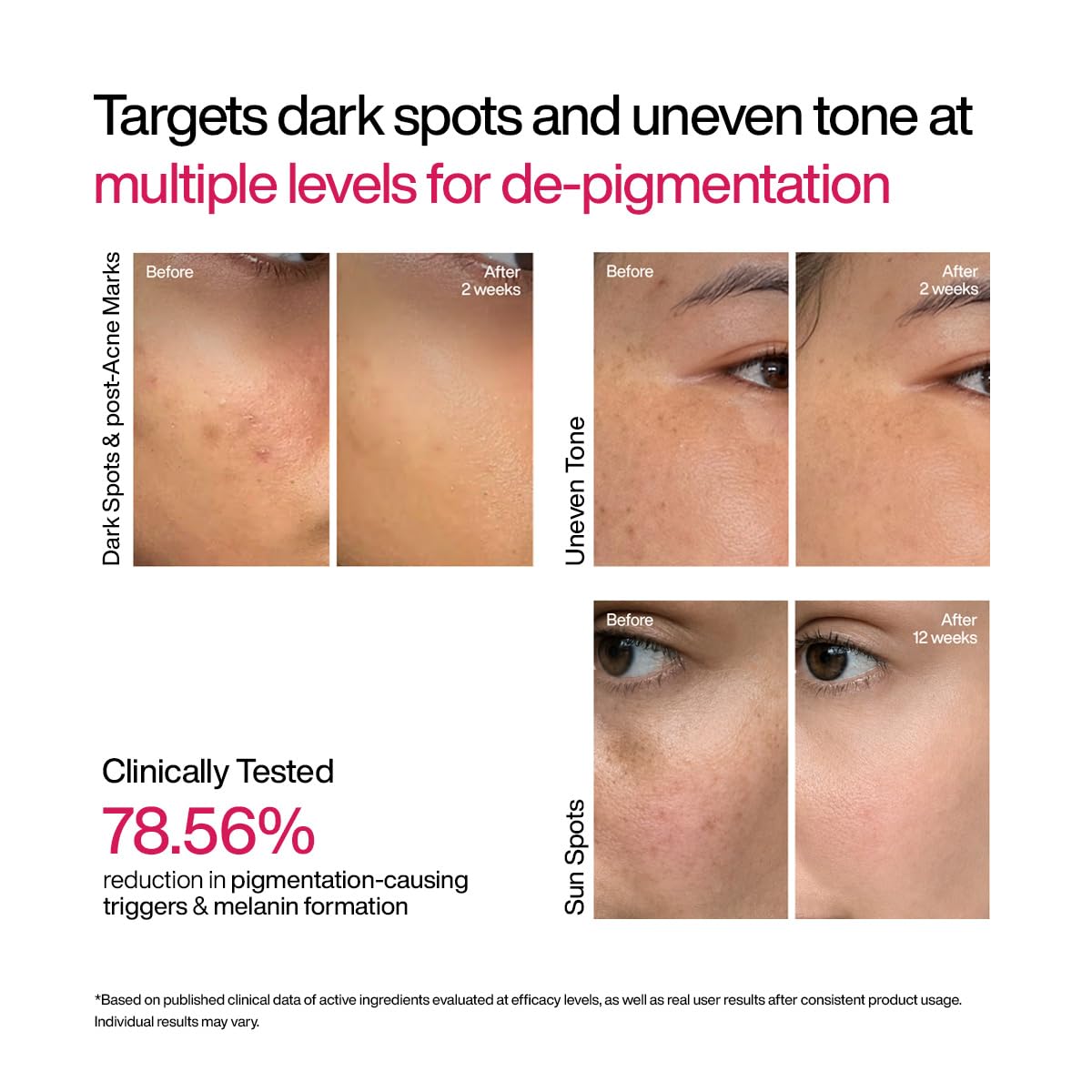 WishCare Advanced Dark Spot Correcting Serum - Niacinamide TXA Shot | 10% Niacinamide Face Serum For Pigmentation and Dark Spot | With 2% Alpha Arbutin & TXA for Glowing Skin | 10ml