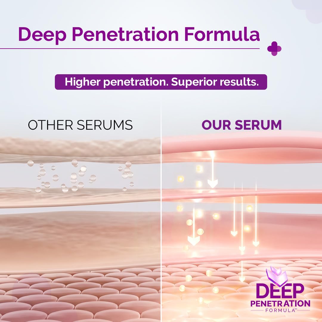 The Derma Co 2% Salicylic Acid Face Serum | Reduces acne & blackheads | Tightens pores | Exfoliates & soothes inflammation | 30 ml