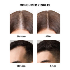 ThriveCo Rosemary Essential Oil for Hair Growth & Hair Fall Control | 100% Pure & Organic | Enriched with Vitamin E | 15ml