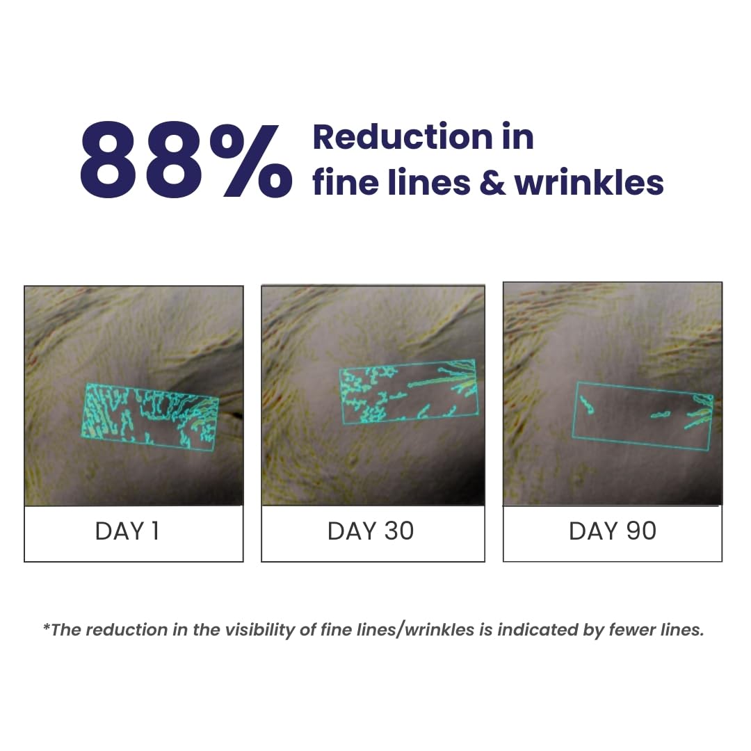 RE' EQUIL 0.1% Retinol Night Cream | Repairs Wrinkles & Fine Lines | Improves Skin Firmness | Beginner Friendly | All Skin Types | Anti Aging Cream For Women & Men 32G