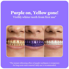 Perfora Purple Whitening Toothpaste-125g | Purple Toothpaste For Teeth Whitening | Teeth Stain Remover | Enamel Safe & Effective Teeth Whitener Oral care | Grape Mint