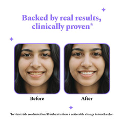 Perfora Purple Teeth Whitening Strips – Pack of 3 Treatments (6 Strips) – Whitens Teeth in 1 Use | Peroxide & Sensitivity-Free, Enamel-Safe Oral Care | PAP & Hydroxyapatite For Stain Removal