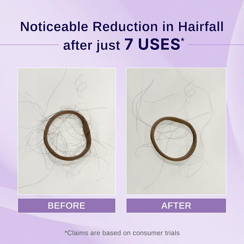 Bare Anatomy Nature x Science Rosemary Hibiscus Hair Growth Oil for Women & Men | Promotes New Hair Growth & Strengthens Hair | Nourishes Scalp & Controls Hair Fall | Suitable for All Hair Types-100ml