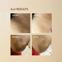 Asaya | Tone Restore | Advanced Pigmentation Cream with MelaMe™ Complex | Anti-Pigmentation Cream for Women & Men for Dark Neck, Knees & Elbows | 50 g