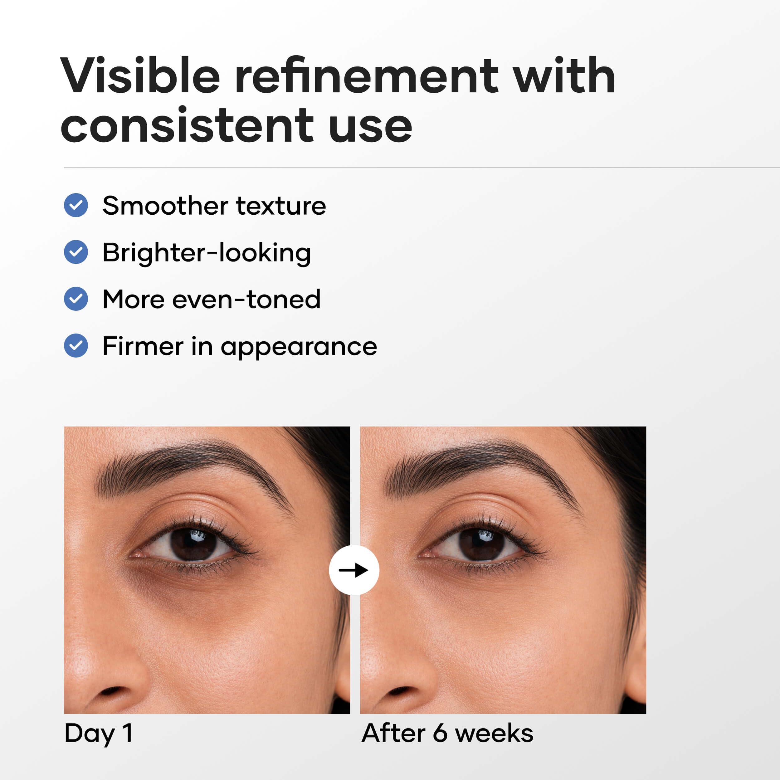 Cureskin Vitamin K + Retinol 0.1% Under Eye Cream