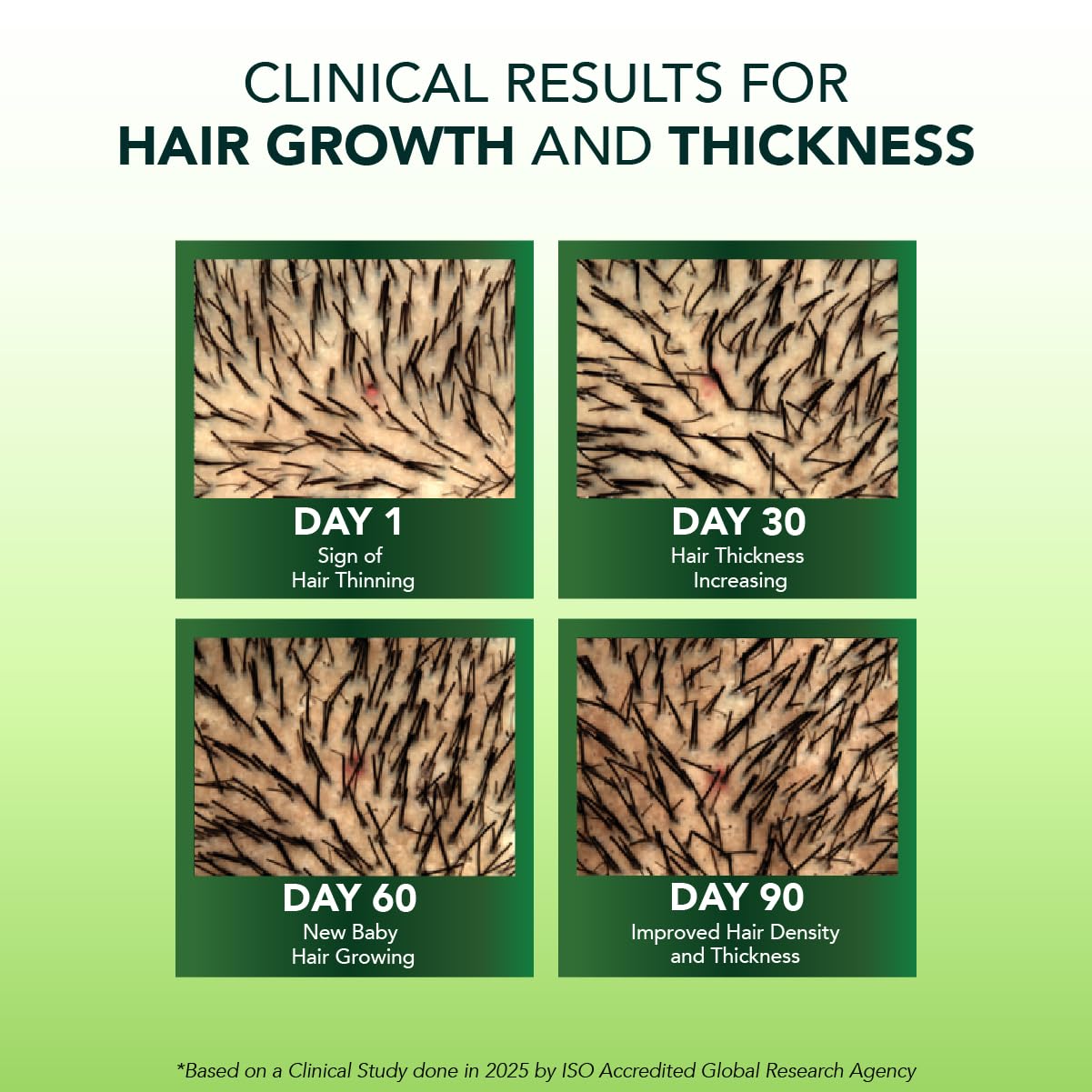Alps Goodness Rosemary Water Spray for Hair Growth (250ml) | Clinically Proven (In Vivo Tested) to Reduce Hair Fall & Promote Regrowth | 100% Natural Rosemary Extract | Leave-On Scalp & Hair Spray