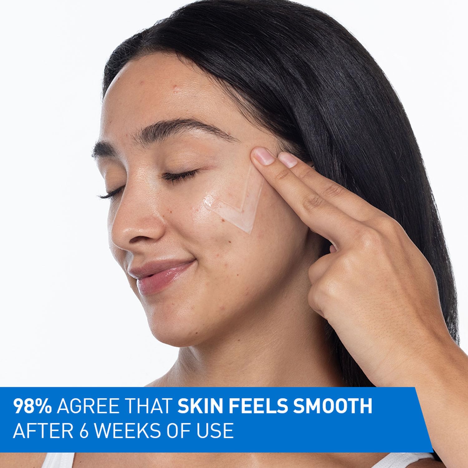 CeraVe Resurfacing Retinol Serum For Blemish-Prone Skin, Reduces Post Acne Marks & Pores, Formulated with Licorice Root Extract & Niacinamide, Non-Comedogenic, 30ml