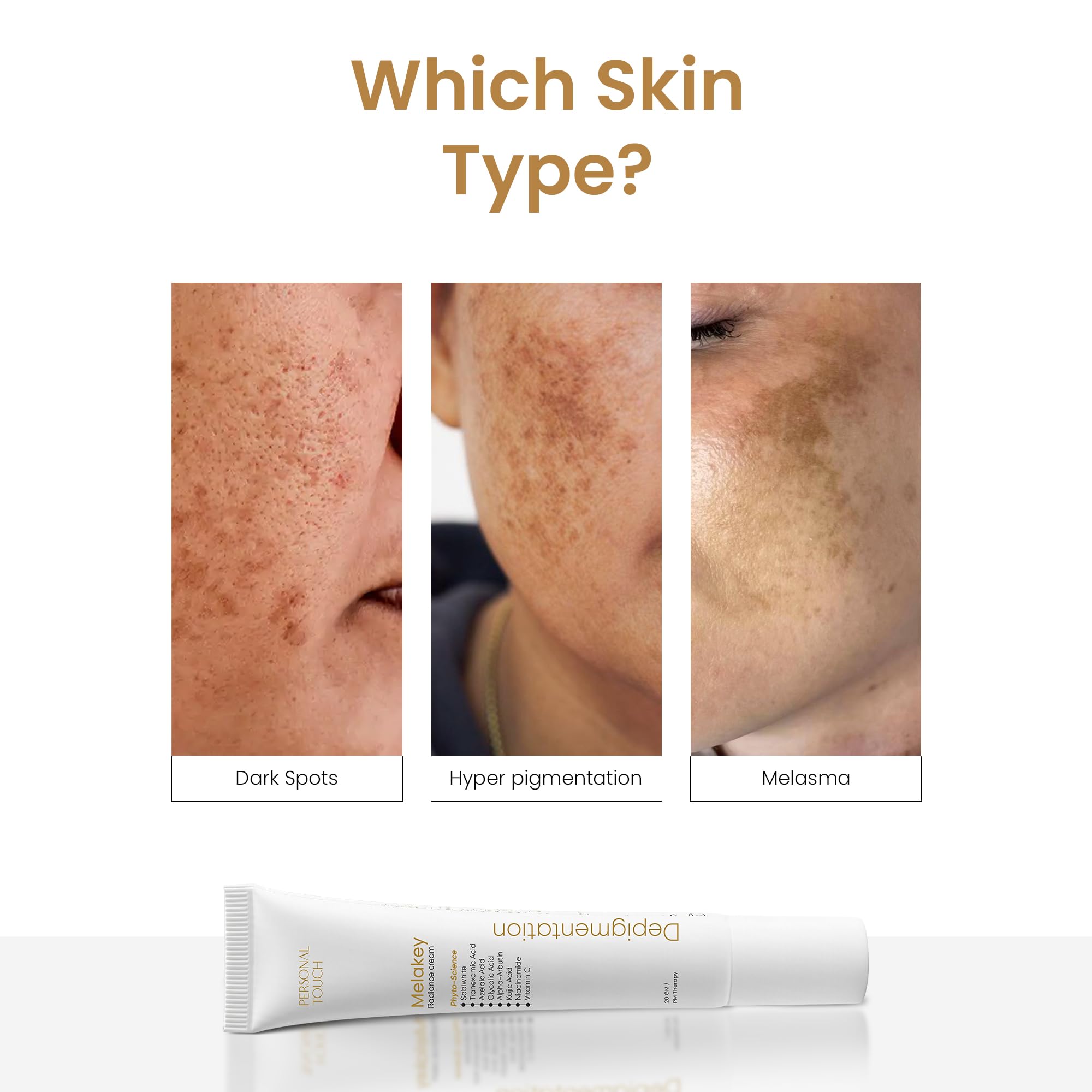Personal Touch Melakey Radiance Cream for Hyperpigmentation & Melasma | Pigmentation Removal Cream | 5% Azelaic Acid | Dark Spot Corrector with Glycolic Acid & Niacinamide for Even Skin Tone | 20gm