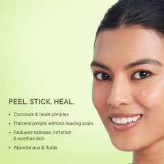 Quench Zit Away Acne Pimple Patches for Face | 24 Hydrocolloid Patches with Salicylic Acid & Cica Herb Repair | Shrinks Pimples Overnight | Acne Treatment | (Pack of 1, Transparent)