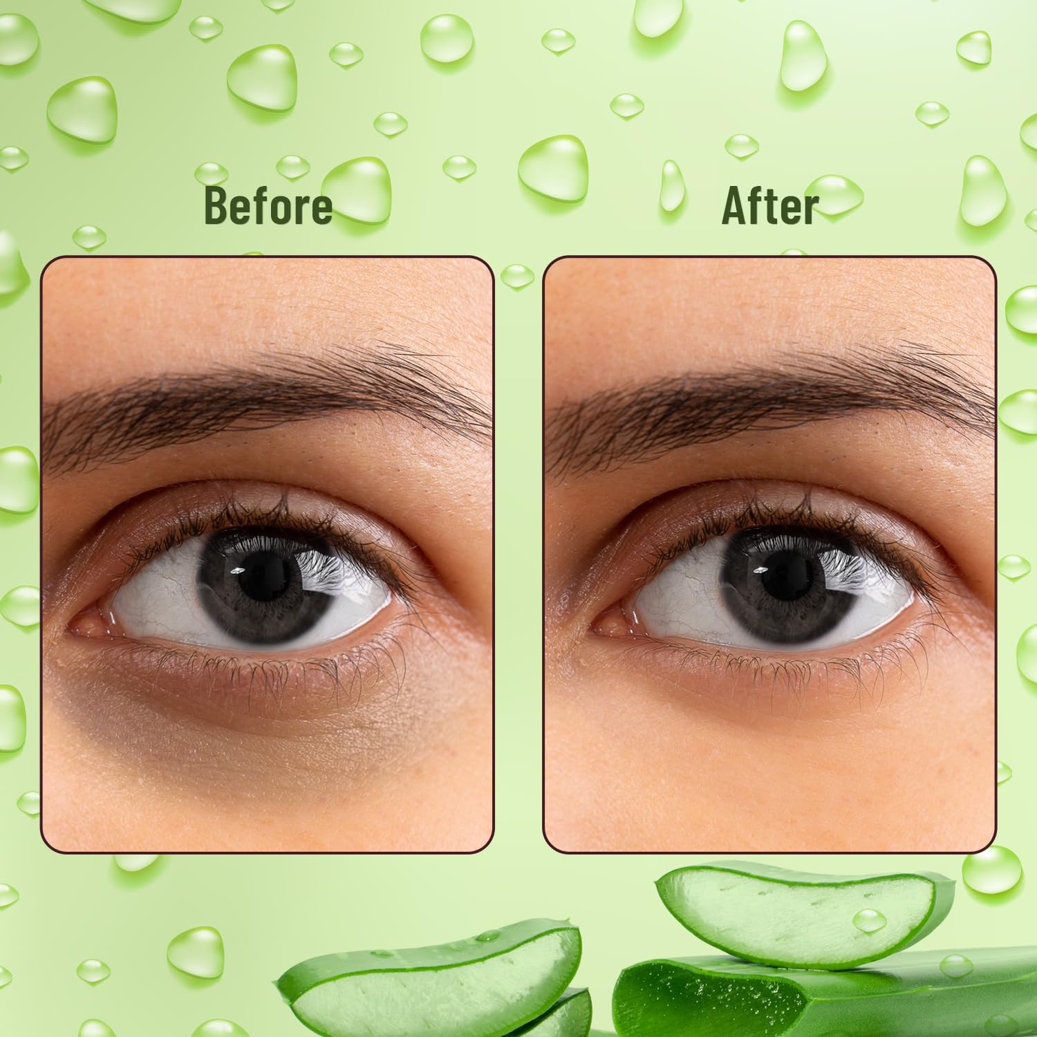 Swiss Beauty Hydra Anti Wrinkle Eye Serum Patch| Treats Dark Circles, Fine Lines And Wrinkles | Enriched With Collagen And Aloe Vera Extract | Shade- Aloevera, 60 Pcs|