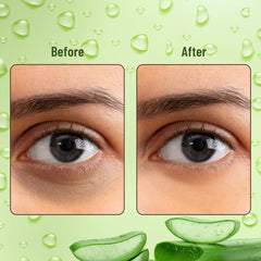 Swiss Beauty Hydra Anti Wrinkle Eye Serum Patch| Treats Dark Circles, Fine Lines And Wrinkles | Enriched With Collagen And Aloe Vera Extract | Shade- Aloevera, 60 Pcs|