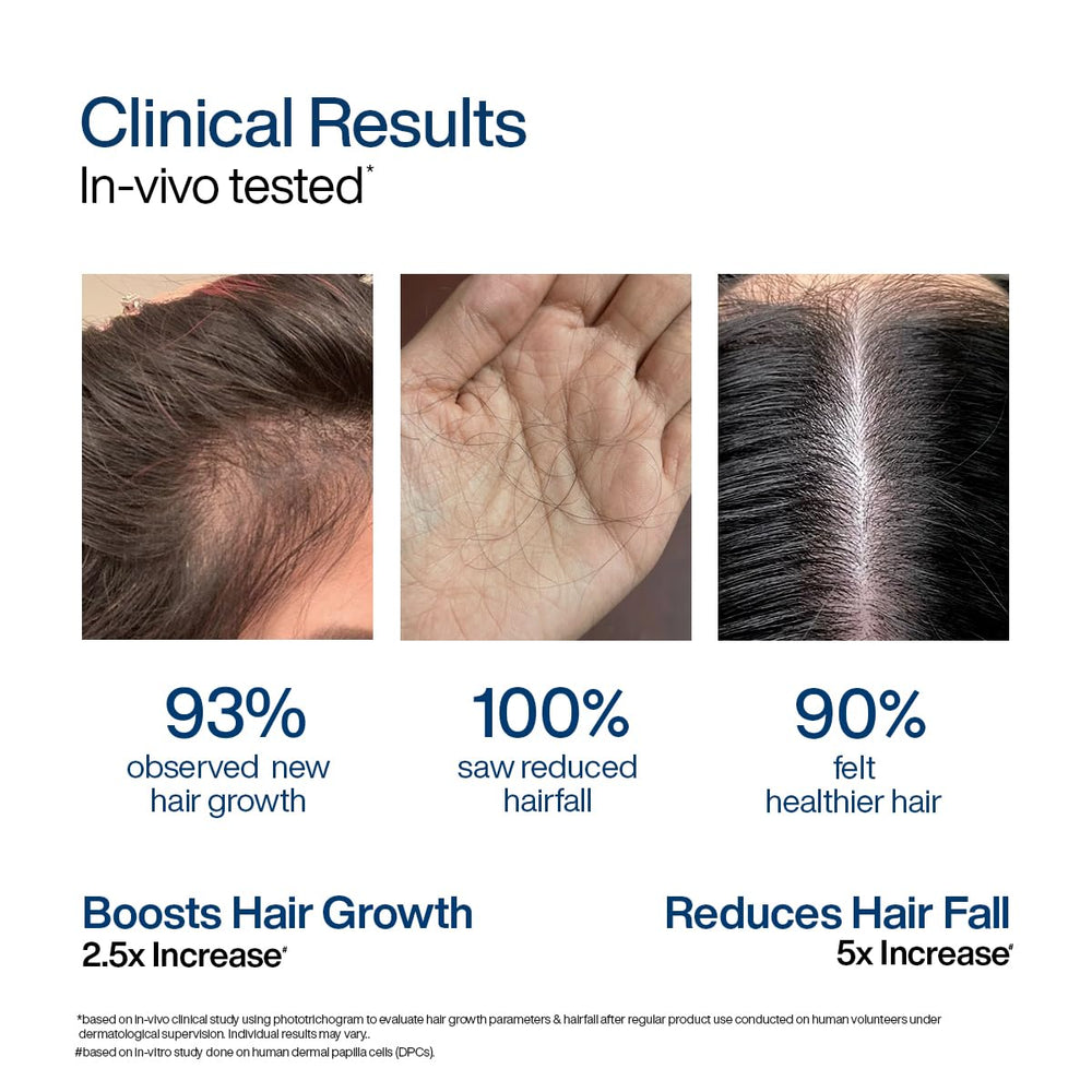 WishCare Hair Growth Serum For Scalp | 94% Saw New Hair Growth | Redensyl & Rosemary Oil | 100% Saw Hairfall Reduction | In-Vivo Tested | For Men & Women | 30ml | Glammy.lk