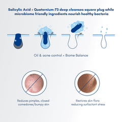 Becalm Daily Salicylic Acid Face Wash for Oily and Acne Prone Skin | Airy face wash for Men & Women | Soap & Sulphate free | Oil, Acne, Dullness, Pore control | Microbiome friendly | With Quaternium - 73 & Prebiotic | No fragrance