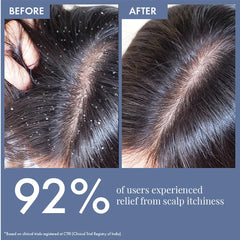 ThriveCo Anti-Dandruff Pre-Shampoo Serum for Itchy, Dry & Flaky Scalp | With Octopirox, Pentavitin & Arginine | Reduces Hair Breakage & Strengthens Hair for Men & Women | 10ml