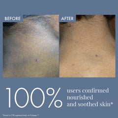 ThriveCo Dark Patches Corrector Cream | Dark Patches Removal | With Retinal & Niacinamide.. For Underarms, Inner Thighs, Knuckles, Elbows & Knees. Men & Women | 100ml