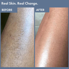 Thriveco Exfoliating Body Wash | Prevents Body Acne, Tan & Dead Skin Removal | With Lactic, Salicylic Acid, Vitamin E & Diacnemide® | Daily Use Shower Gel | For Men & Women | 236ml