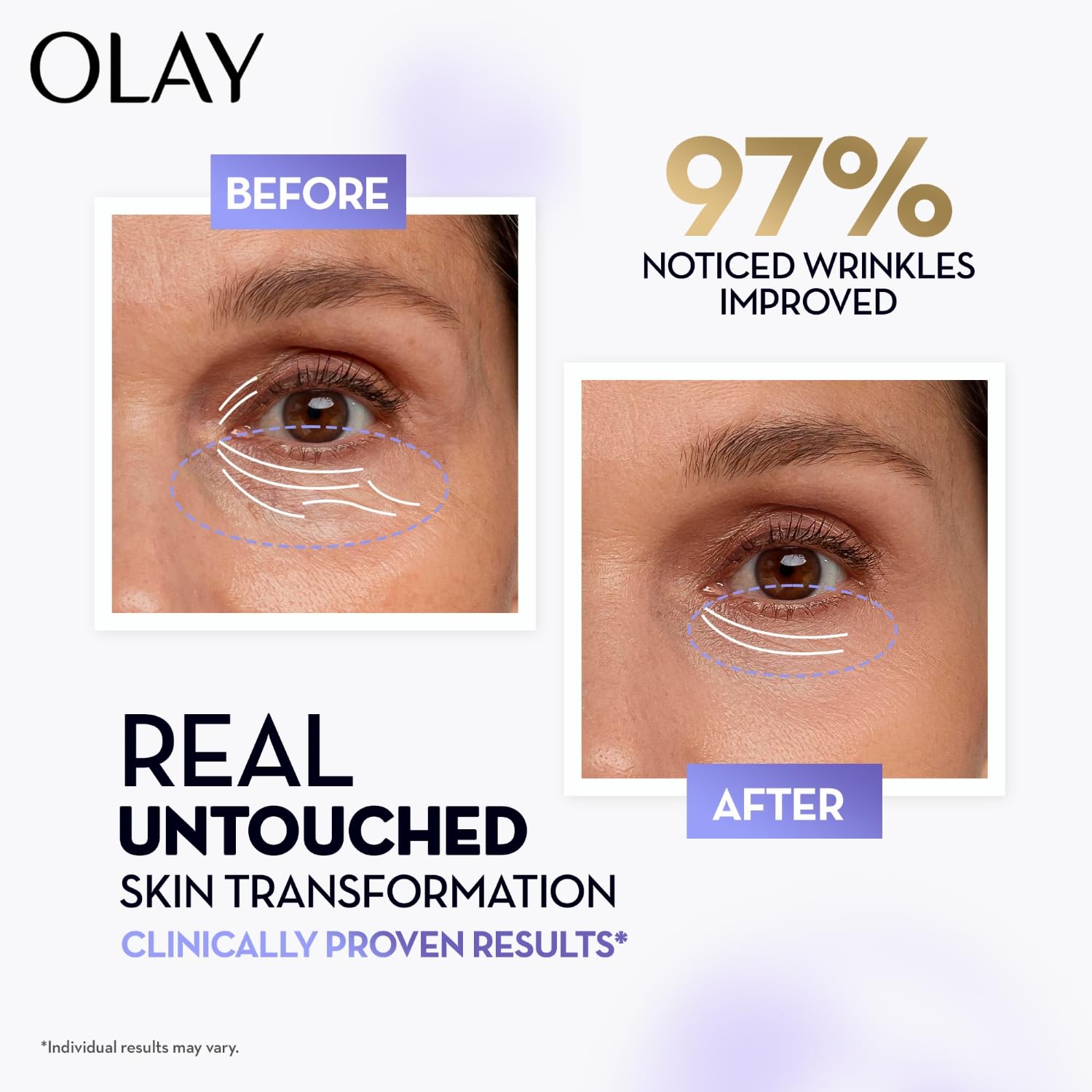 Olay Retinol24 Max Night Cream l Visibly Reduces Fine Lines in 7 Nights | Max Repair, Max Hydration l No Redness or Irritation | Fragrance Free l Normal, Oily, Dry and Combination Skin l 50g