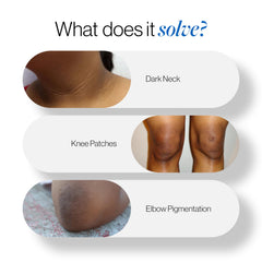Be Bodywise Pigmentation Cream 100gm | 2.5% Lactic Acid, 2% Urea, Retinol & Kojic Acid | Reduces Tan, Pigmentation & Evens Skin Tone | Treats Dark Patches & Rough Skin on Elbows, Knees, Back of Neck & Thighs | For Daily Use