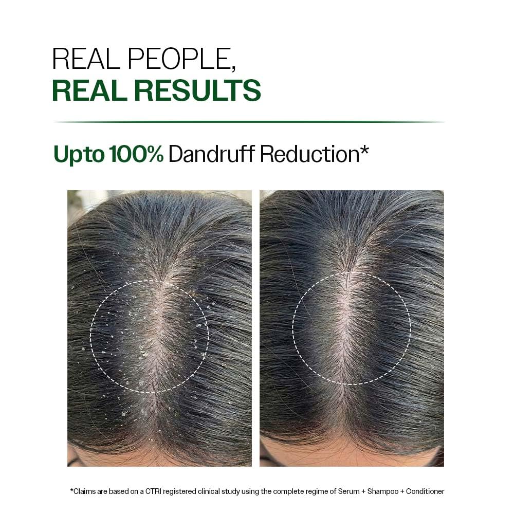 Bare Anatomy Anti-Dandruff Shampoo | Up To 100% Dandruff Reduction | 100 ml