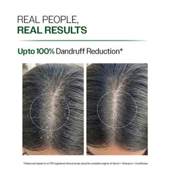 Bare Anatomy Anti-Dandruff Shampoo | Up To 100% Dandruff Reduction | 100 ml